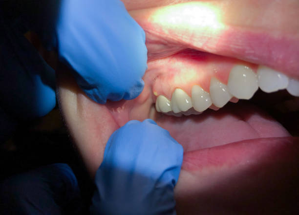 Best Urgent Tooth Repair  in New Waverly, TX